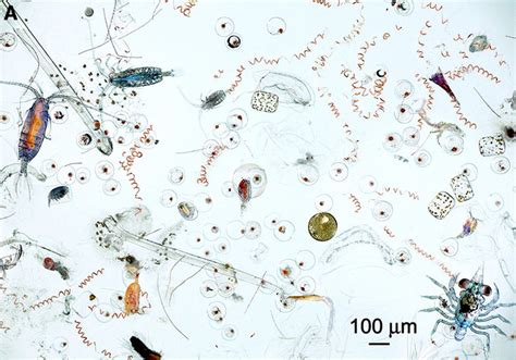  Dalyellium!  A Miniature Marvel Unfolding Microscopic Mysteries in Freshwater Ecosystems