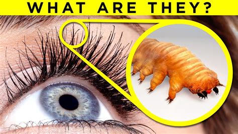  Eyelash Worm: This Tiny Creature Crawls Through Your Eyeballs and Lives in Your Tear Ducts!