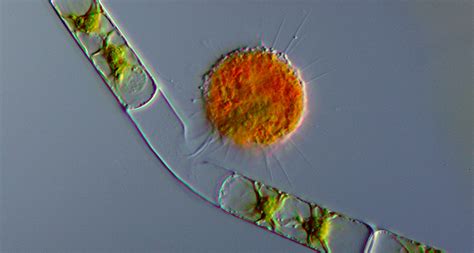  Reticulomyxa:  An Amoeboid Master of Shape-Shifting and Exquisite Food Acquisition!